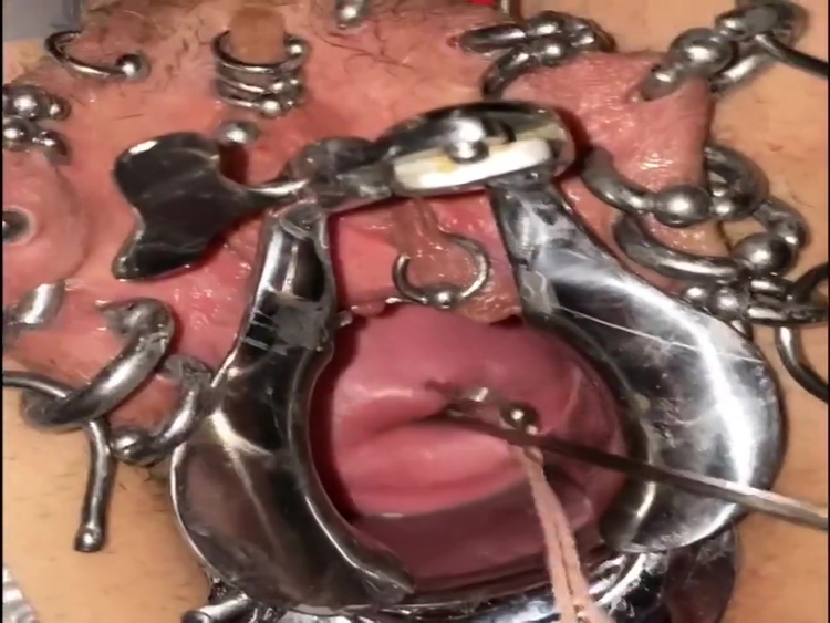 Extreme cervix sounding_main_thumbnail